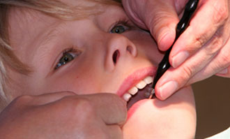 Dental-Care-Tips-for-Childrens
